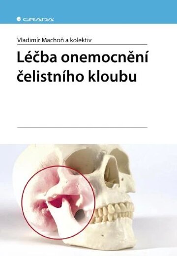 Obálka knihy Léčba onemocnění čelistního kloubu