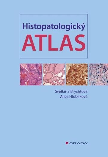Obálka knihy Histopatologický atlas