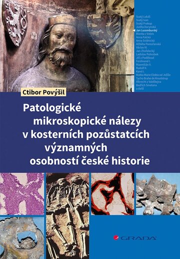 Obálka knihy Patologické mikroskopické nálezy v kosterních pozůstatcích významných osobností české historie