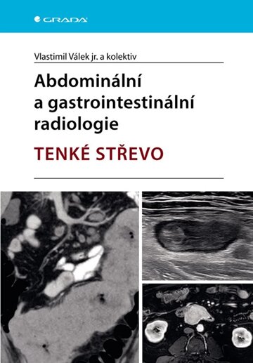 Obálka knihy Abdominální a gastrointestinální radiologie