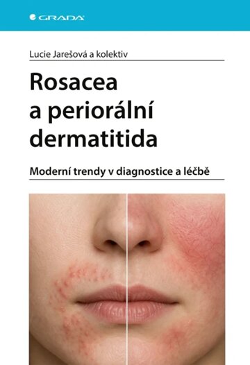Obálka knihy Rosacea a periorální dermatitida