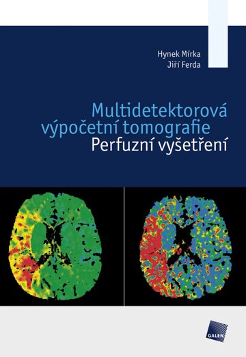 Obálka knihy Multidetektorová výpočetní tomografie