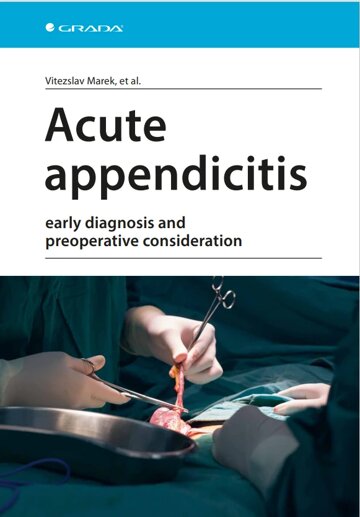 Obálka knihy Acute appendicitis