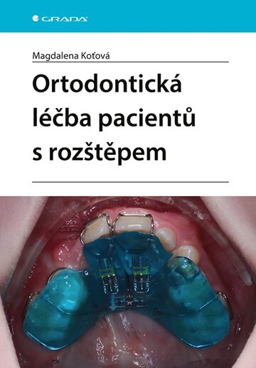Obálka knihy Ortodontická léčba pacientů s rozštěpem