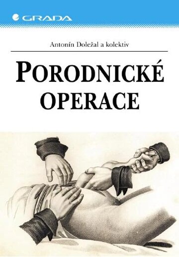 Obálka knihy Porodnické operace