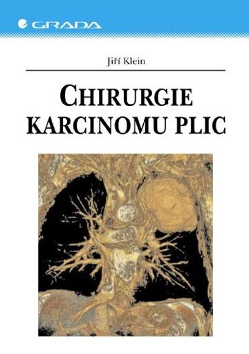 Obálka knihy Chirurgie karcinomu plic
