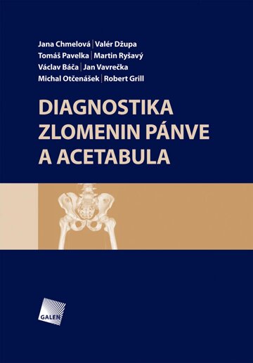 Obálka knihy Diagnostika zlomenin pánve a acetabula