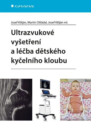 Obálka knihy Ultrazvukové vyšetření a léčba dětského kyčelního kloubu