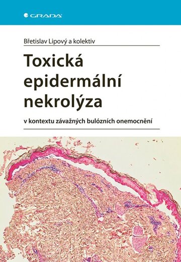 Obálka knihy Toxická epidermální nekrolýza