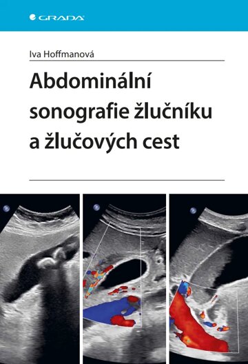 Obálka knihy Abdominální sonografie žlučníku a žlučových cest