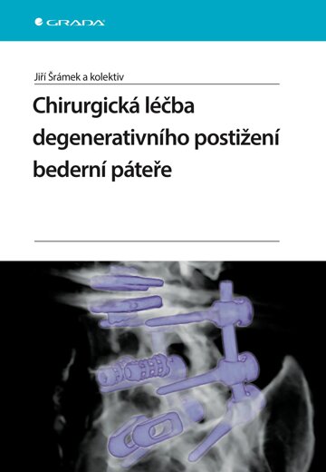 Obálka knihy Chirurgická léčba degenerativního postižení bederní páteře