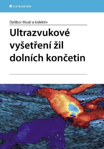 Obálka knihy Ultrazvukové vyšetření žil dolních končetin